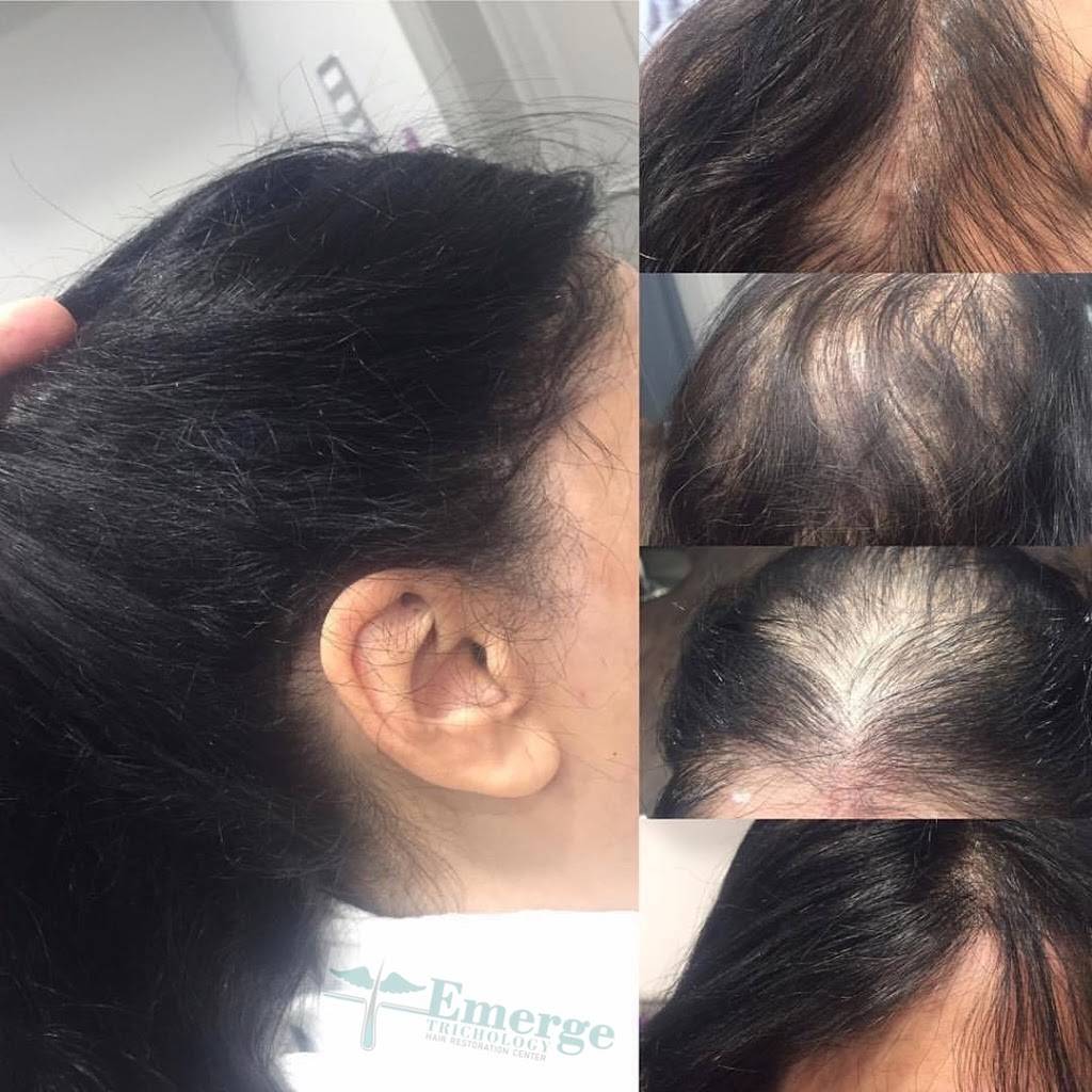 Emerge Hair Restoration | 7403 Temple Terrace Hwy suite a, Temple Terrace, FL 33637, USA | Phone: (813) 820-0022