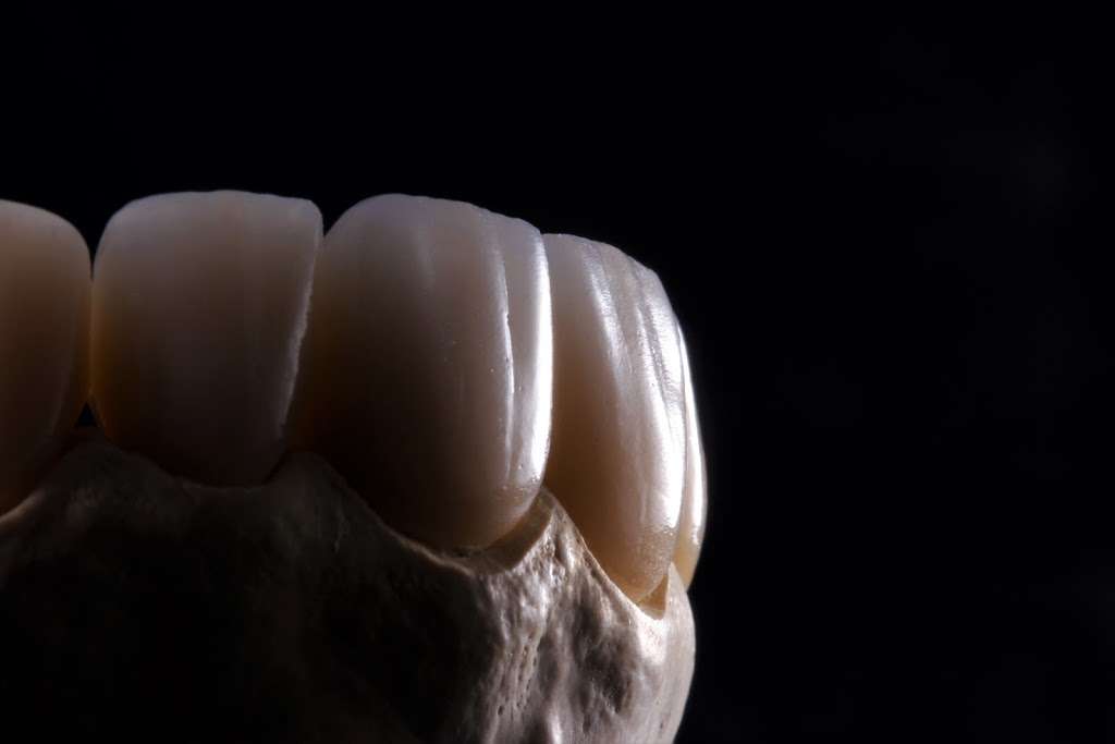 Progressive Dental Ceramics | 2100 Carlmont Dr #2, Belmont, CA 94002, USA | Phone: (650) 592-1938