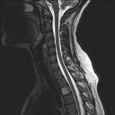 InSight Medical Imaging | 2009 Warrenville Rd, Lisle, IL 60532, USA | Phone: (630) 225-4343