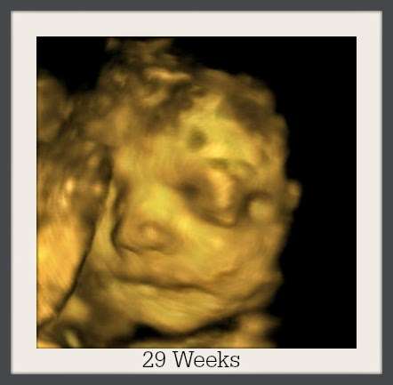 Bella Baby 4D Ultrasound of Houston | 3411 Cedar Knolls Dr, Kingwood, TX 77339, USA | Phone: (281) 407-0470