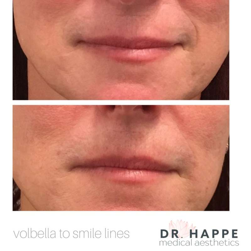 Dr. Happe Medical Aesthetics, LLC | 15 Homestead St, Waban, MA 02468, USA | Phone: (617) 597-2600