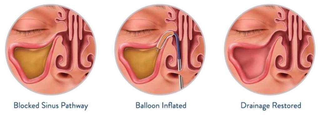 Morrow-Syed Ear Nose & Throat Physicians, Otolaryngology | 601 U.S. 9 Suite A-2, Cape May Court House, NJ 08210, USA | Phone: (609) 463-5888