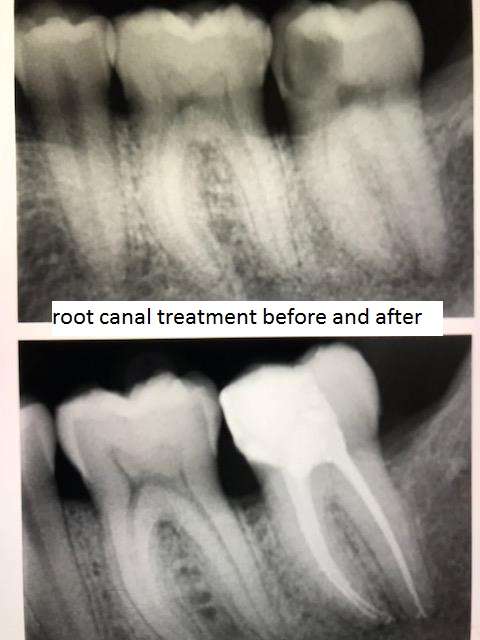 NJ Dental LLC (Yan Liu, DDS) (Cosmetic and Implant Dentistry) | 2 Dean Dr 1st floor, Tenafly, NJ 07670, United States | Phone: (201) 569-8423