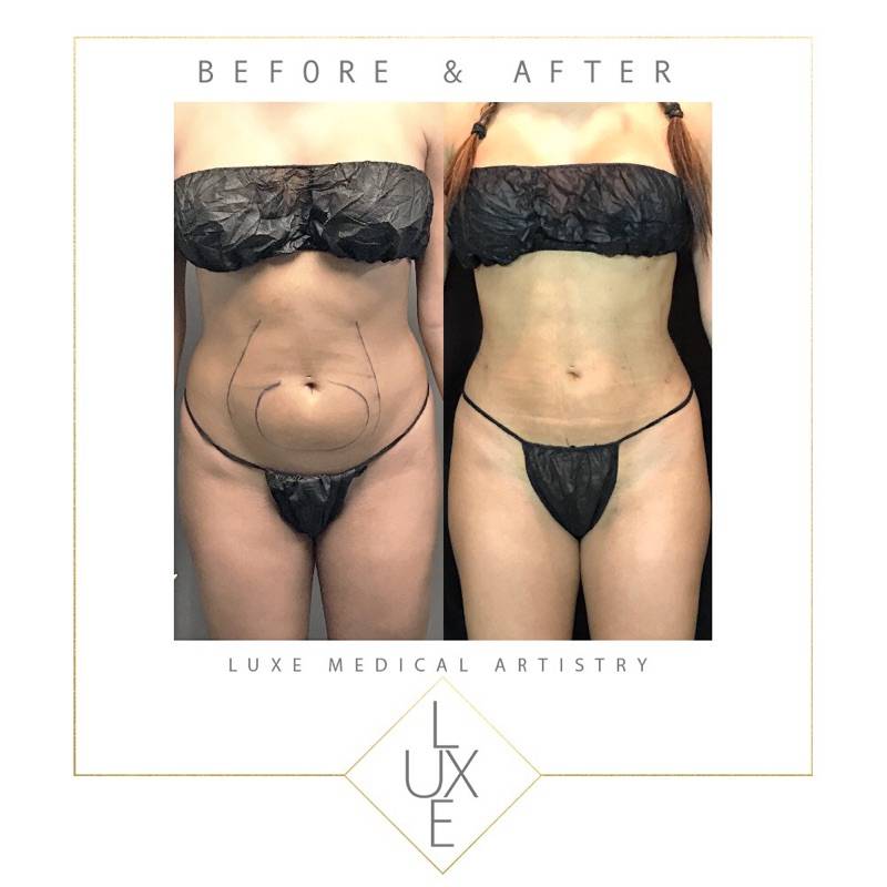 Luxe Medical Artistry | 7425 E Shea Blvd #103, Scottsdale, AZ 85260, USA | Phone: (480) 500-5406