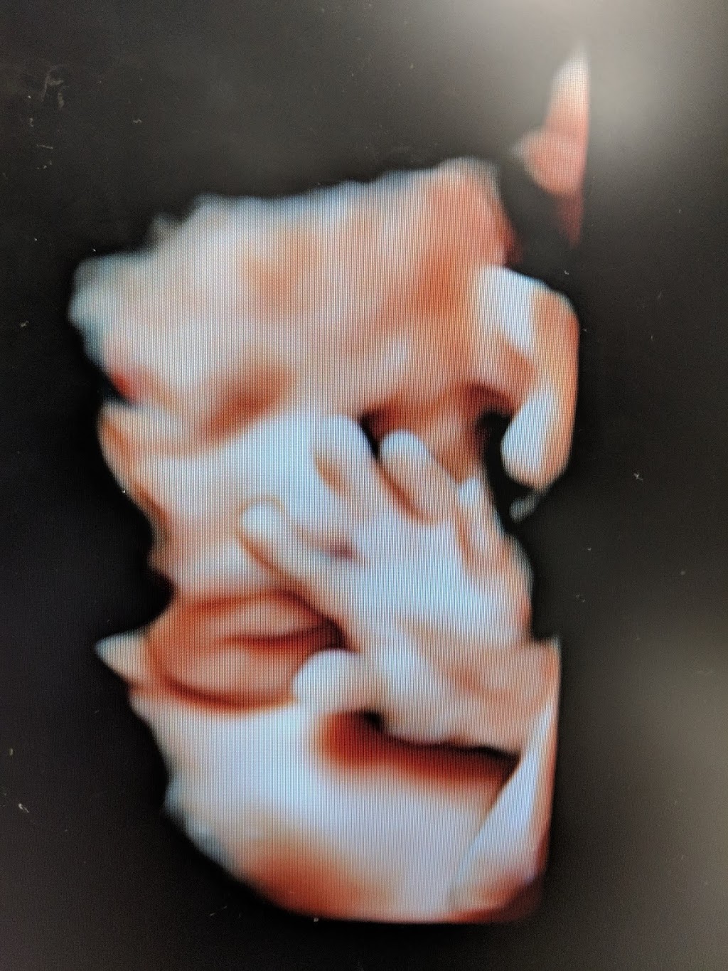 Sweet Baby Face HD 3D 4D 5D Ultrasound | 3422 Stony Spring Cir, Louisville, KY 40220, USA | Phone: (502) 509-1003