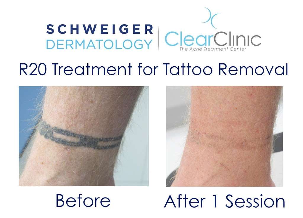 Schweiger Dermatology Group - Livingston | 315 E Northfield Rd Suite 2A, Livingston, NJ 07039, USA | Phone: (973) 736-0885