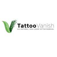 Tattoo Vanish | 1409 W 49th St Suite 2, Hialeah, FL 33012, United States | Phone: (844) 582-6474