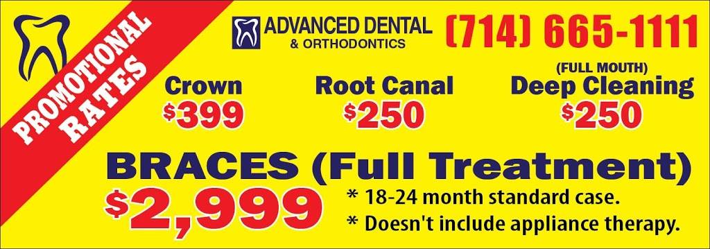 Advanced Dental Group | 1450 El Camino Real Unit #D, Tustin, CA 92780, USA | Phone: (714) 665-1111