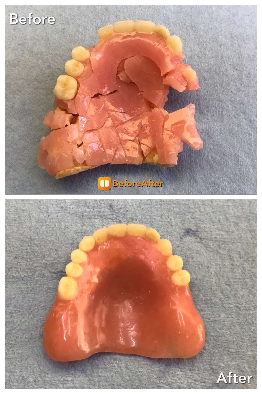 Denture Repairs by Lori | 3405 Quince St, San Diego, CA 92104, USA | Phone: (619) 851-1169