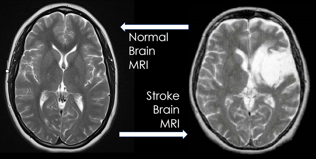 Neurology Consultants of Dallas, PA | 8390 Lyndon B Johnson Fwy Suite 1000, Dallas, TX 75243, USA | Phone: (214) 750-9977