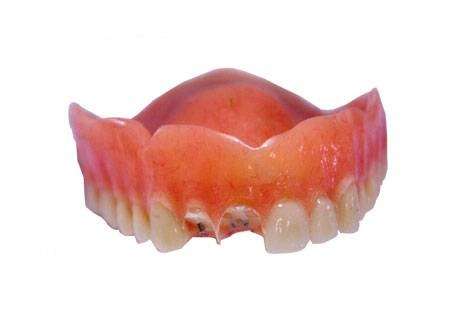 Denture Repairs by Lori | 3405 Quince St, San Diego, CA 92104, USA | Phone: (619) 851-1169