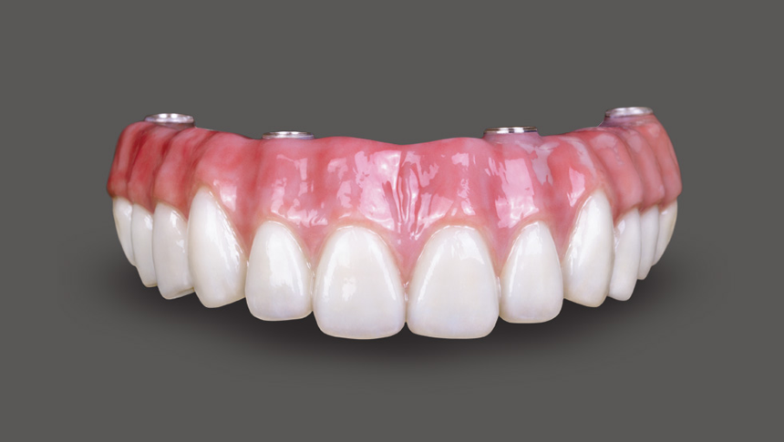 Periodontics and Dental Implants of North Carolina | 6101 Grace Park Dr, Morrisville, NC 27560, USA | Phone: (919) 493-9900