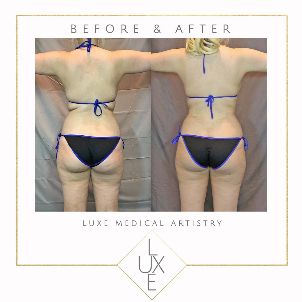 Luxe Medical Artistry | 7425 E Shea Blvd #103, Scottsdale, AZ 85260, USA | Phone: (480) 500-5406