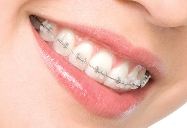 Vistancia Orthodontics Peorias Orthodontist | 9772 W Yearling Rd A-1600, Peoria, AZ 85383, USA | Phone: (623) 566-0800