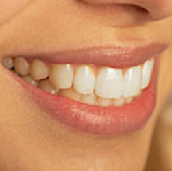 Lantern Dental | 412 E Pleasant Run Rd, DeSoto, TX 75115, USA | Phone: (972) 274-9300