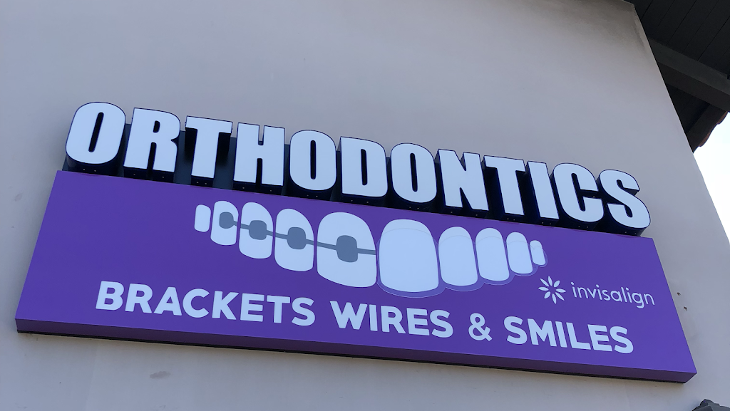 Brackets Wires and Smiles Orthodontics | 1245 E Vista Way, Vista, CA 92084, USA | Phone: (760) 407-0104