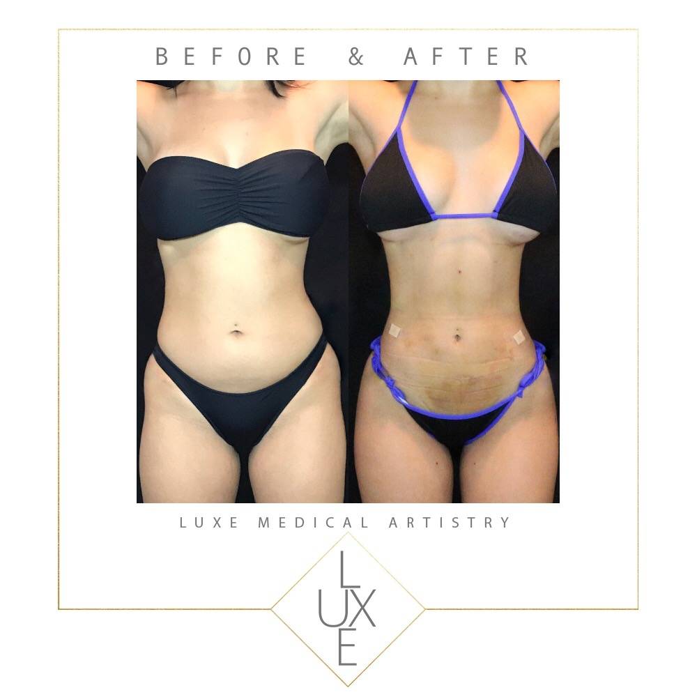 Luxe Medical Artistry | 7425 E Shea Blvd #103, Scottsdale, AZ 85260, USA | Phone: (480) 500-5406