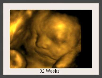 Bella Baby 4D Ultrasound of Houston | 3411 Cedar Knolls Dr, Kingwood, TX 77339, USA | Phone: (281) 407-0470