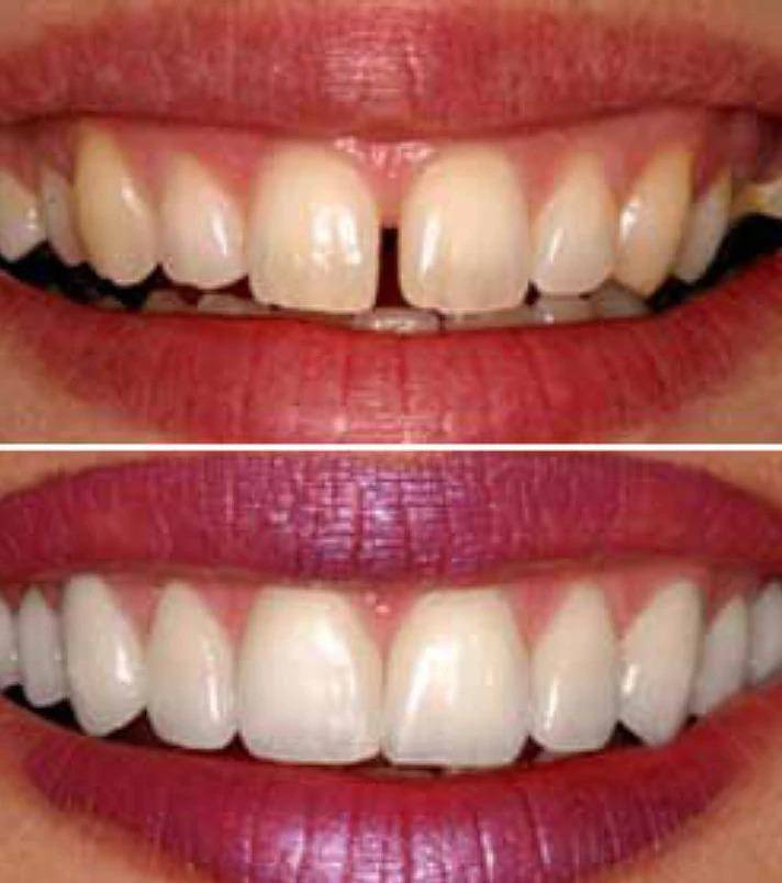 Flossophy Dental | 4145 S Gilbert Rd #3, Chandler, AZ 85249, USA | Phone: (480) 534-1106