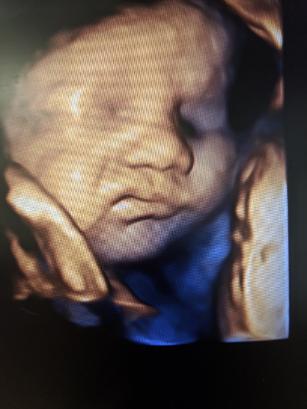 Sweet Baby Face HD 3D 4D 5D Ultrasound | 3422 Stony Spring Cir, Louisville, KY 40220, USA | Phone: (502) 509-1003