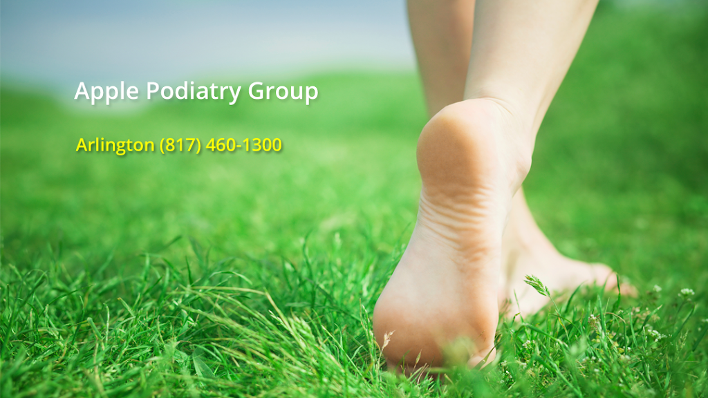 Apple Podiatry Group | 3600 Matlock Rd #104, Arlington, TX 76015, USA | Phone: (817) 200-4113