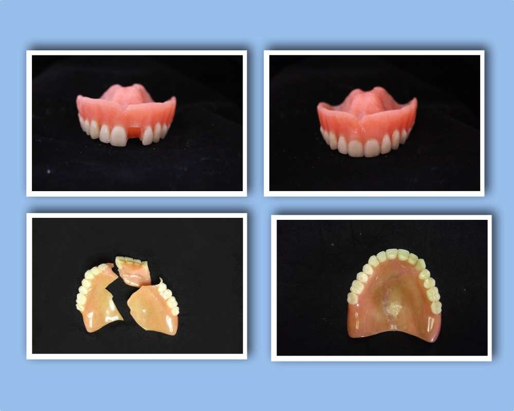 Denture Repairs by Lori | 3405 Quince St, San Diego, CA 92104, USA | Phone: (619) 851-1169