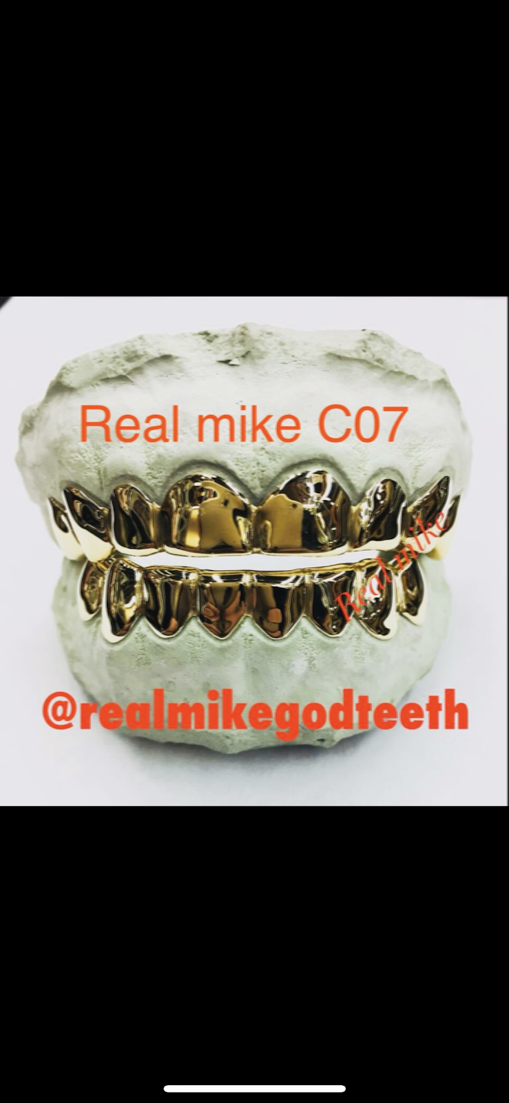 Real Mike Gold Teeth | 7900 NW 27th Ave 2nd floor, Unit C07, Miami, FL 33147, USA | Phone: (786) 527-1108