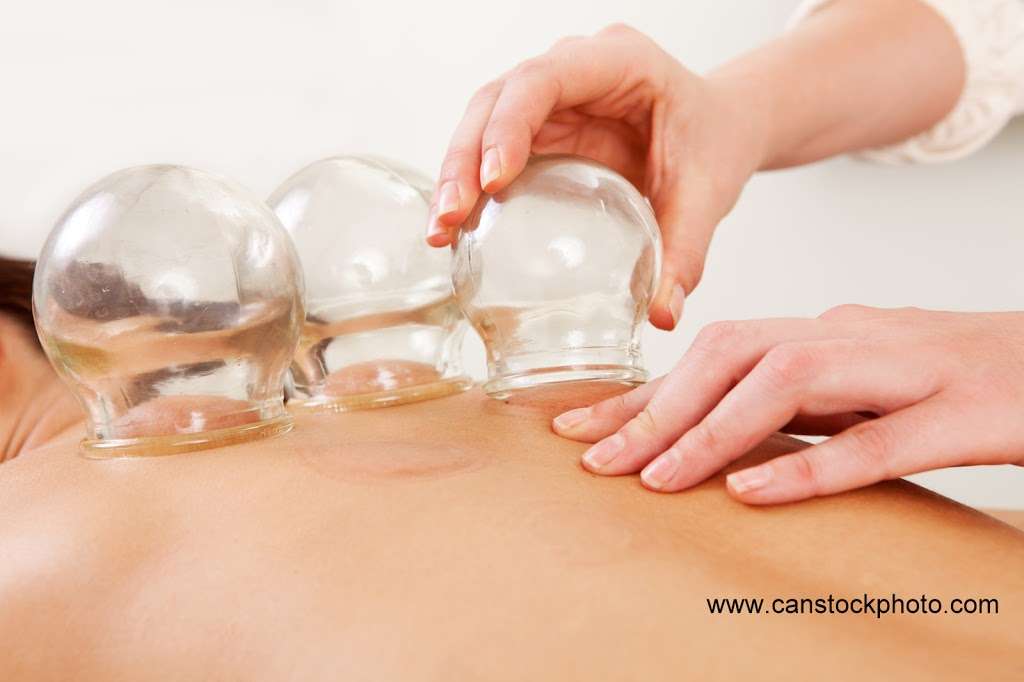 Lotus Healing Acupuncture | 736 Polhemus Rd, San Mateo, CA 94402, USA | Phone: (650) 206-9386