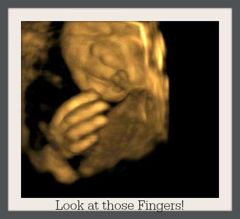 Bella Baby 4D Ultrasound of Houston | 3411 Cedar Knolls Dr, Kingwood, TX 77339, USA | Phone: (281) 407-0470