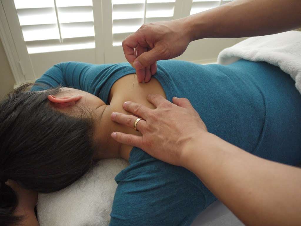 AQure Acupuncture Wellness Center | inside Alex Burton Salons, 2745D Town Center Blvd N Ste 168, Sugar Land, TX 77479, USA | Phone: (281) 975-9931