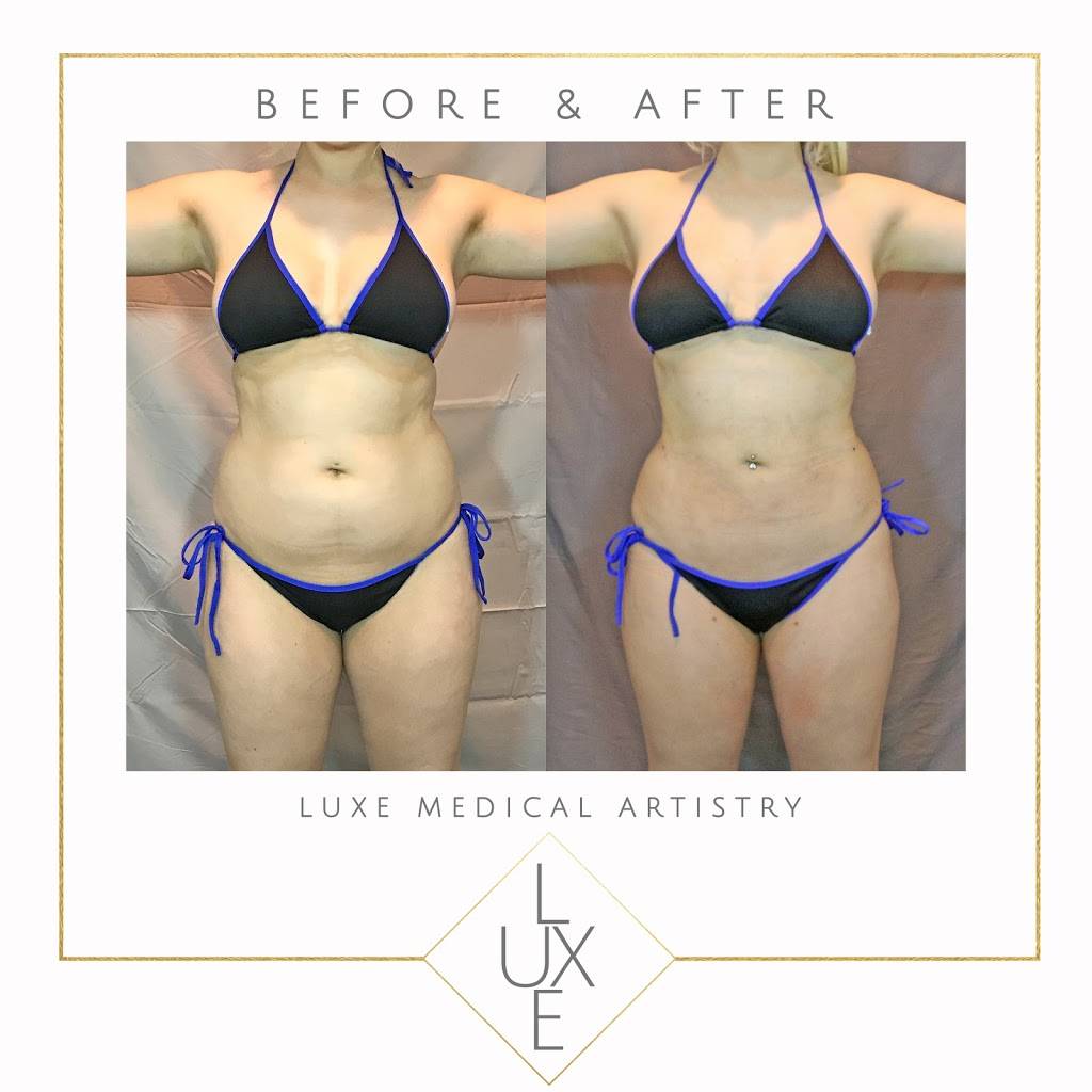 Luxe Medical Artistry | 7425 E Shea Blvd #103, Scottsdale, AZ 85260, USA | Phone: (480) 500-5406