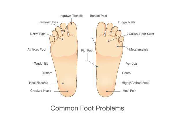 Modern Podiatric Care, PC | 1484 E 87th St, Brooklyn, NY 11236, USA | Phone: (718) 360-1393