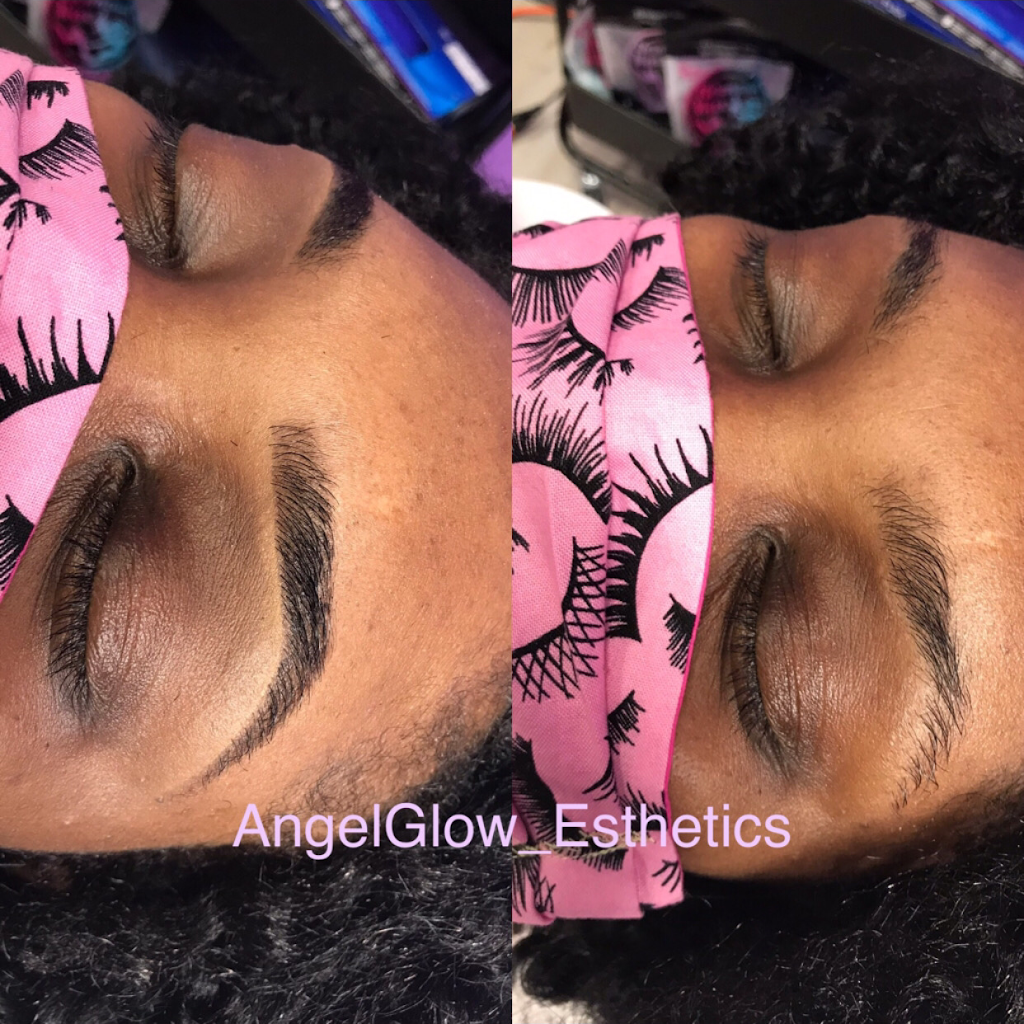 AngelGlow Esthetics | 6491 Winchester Rd, Memphis, TN 38115, USA | Phone: (901) 230-8114