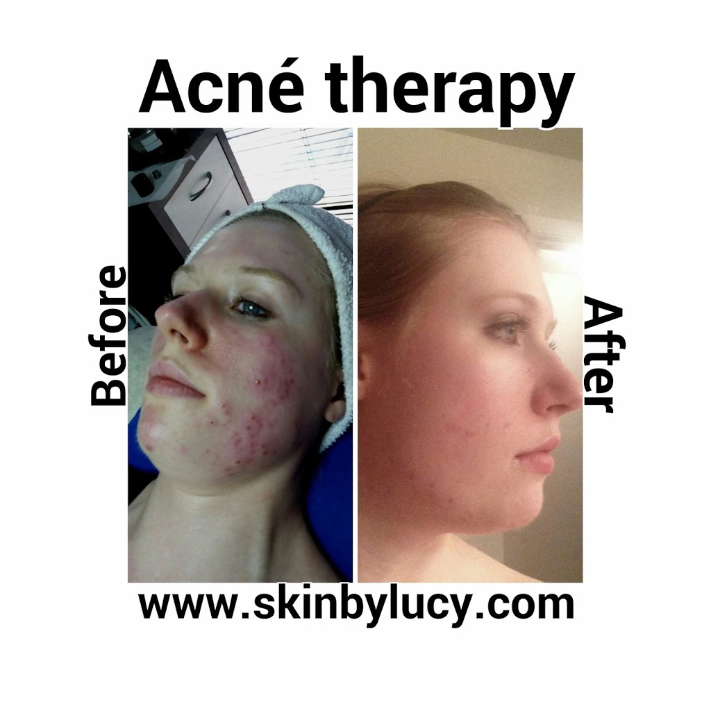 Skin By Lucy Med | 7000 Parkwood Blvd e100, Frisco, TX 75034, USA | Phone: (972) 854-2267