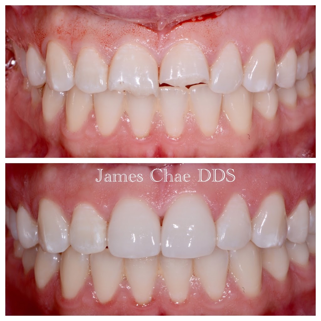 Chae James DDS | 2040 S Brea Canyon Rd # 210, Diamond Bar, CA 91765, USA | Phone: (909) 396-0077