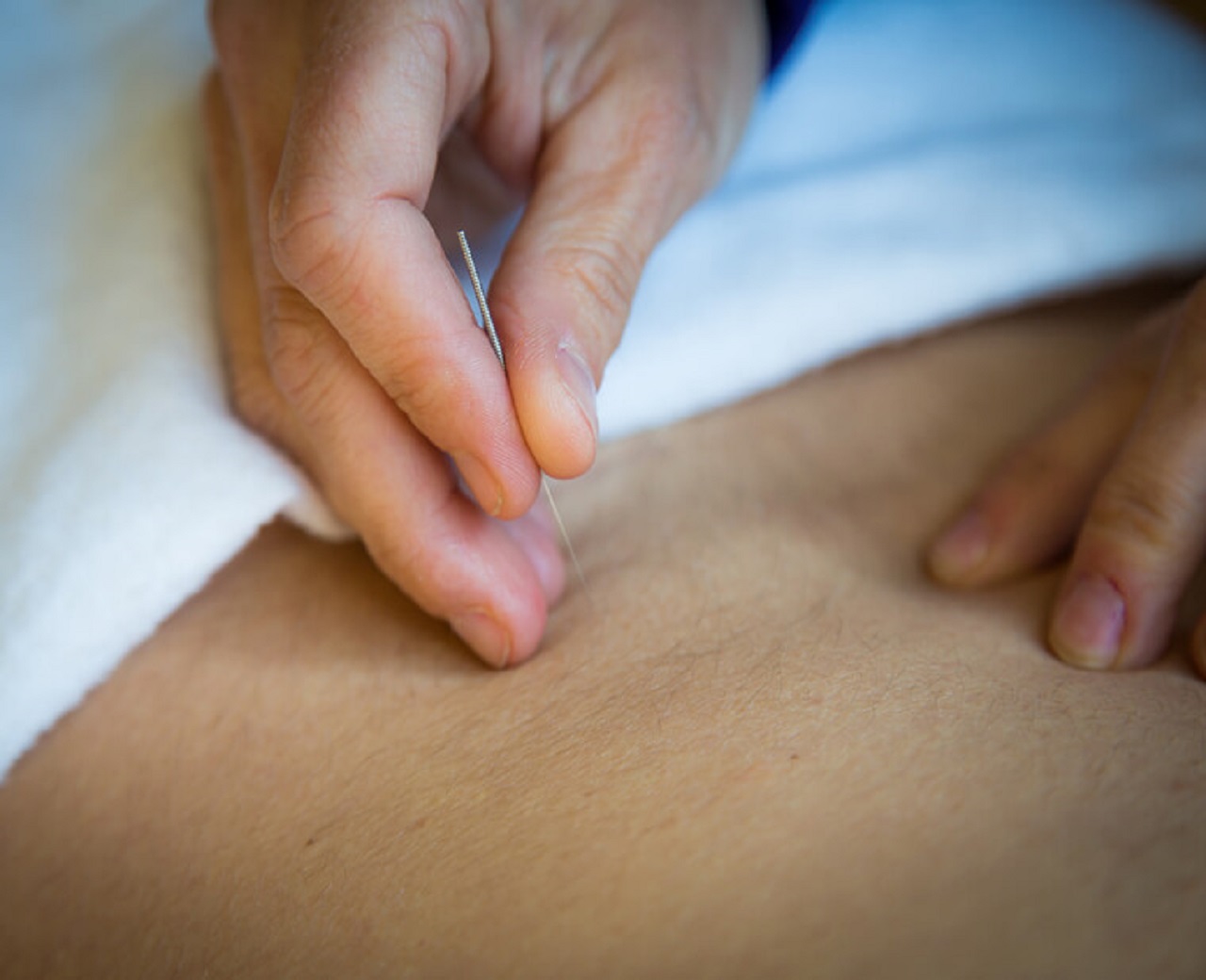 Acupuncture In Kelowna | 1441 Ellis St #102, Kelowna, BC V1Y 2A3, Canada | Phone: (778) 721-5828