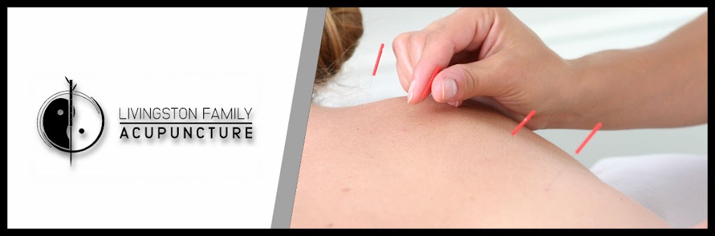 Livingston Family Acupuncture | 25 W Northfield Rd, Livingston, NJ 07039, USA | Phone: (973) 498-8058