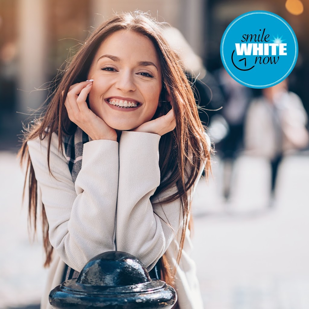 Smile White Now | 5850 Eubank Blvd NE Suite B42, Albuquerque, NM 87111, USA | Phone: (505) 508-5377