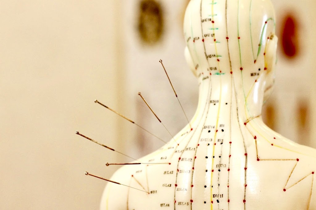 True Acupuncture and Wellness | 1000 Physicians Way #144, Franklin, TN 37067, USA | Phone: (615) 975-7320